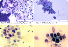 Conventional cytology
